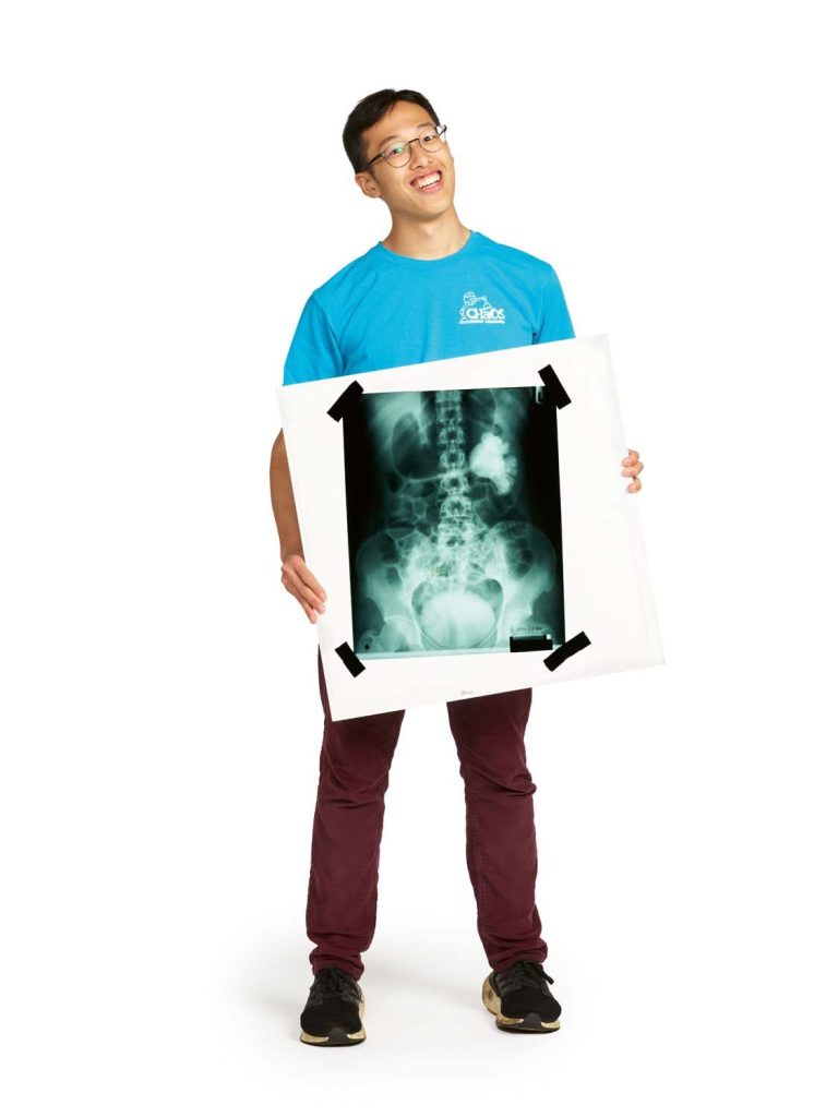 Student holding x-ray